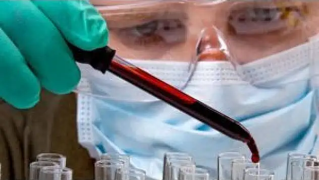 Kocaeli'de domuz gribi can aldı