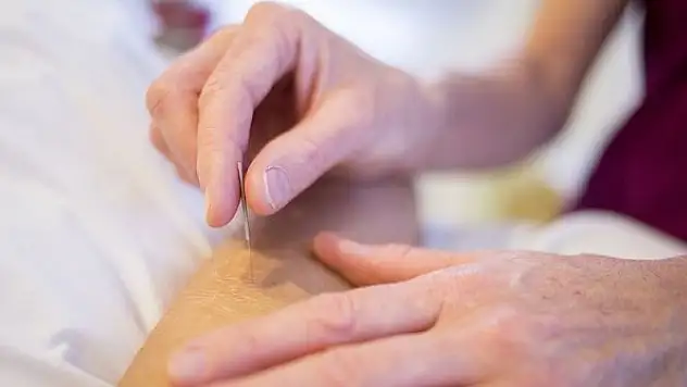 Akupunktur Kovid-19'un etkilerini hafifletmede ümit vadeden bir tedavi yöntemi olabilir