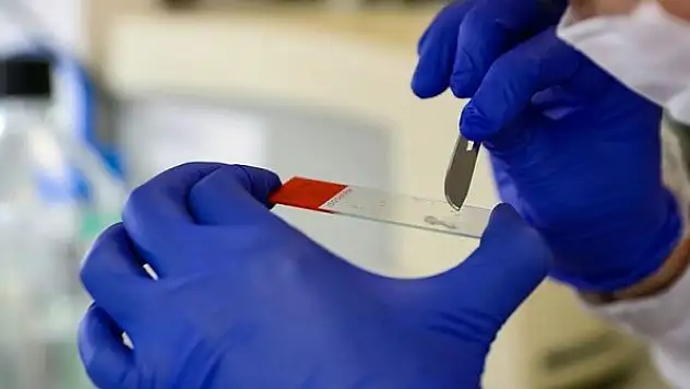 Transgenik fareler Kovid-19 aşısı ve ilaç çalışmalarını hızlandıracak