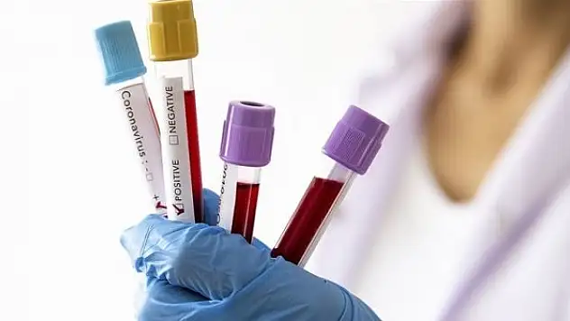 Kuzey Kore, Covid-19 vakaları için Güney Kore'yi suçladı