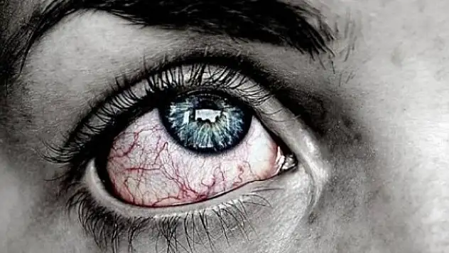 Koronavirüs belirtileri gözlerde de görülebiliyor