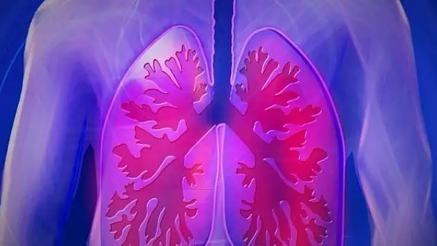 Akciğer kanseri dünya genelinde saatte 20 can alıyor