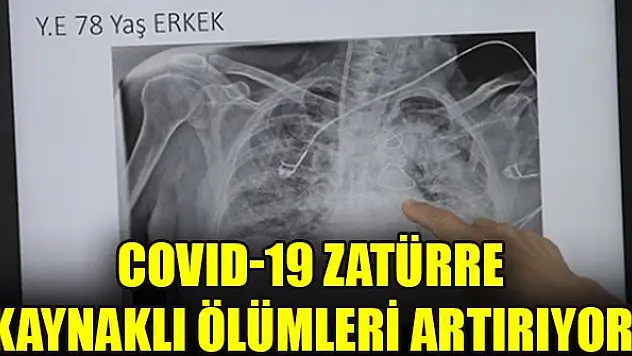 COVID-19 zatürre kaynaklı ölümleri artırıyor