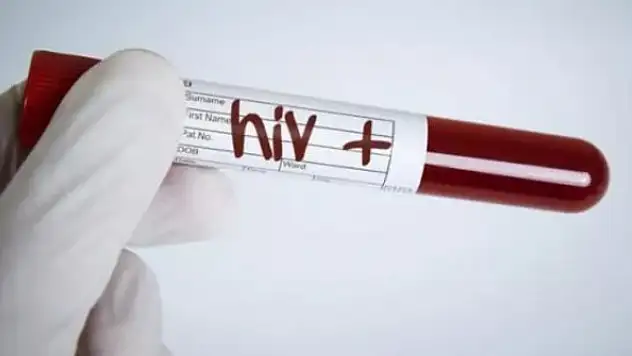 Sağlık Bakanlığı açıkladı: 26 bin kişi HIV pozitif