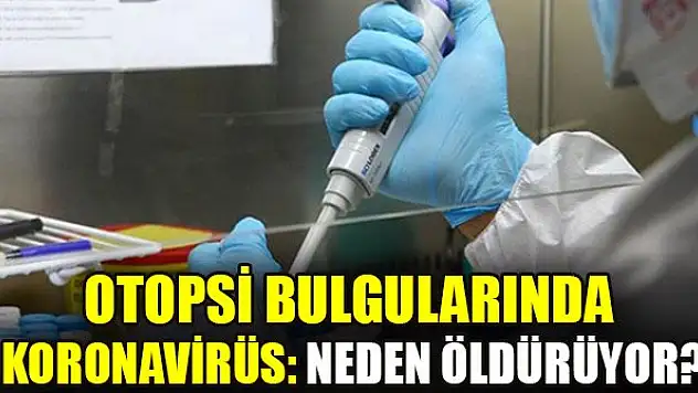 Otopsi bulgularında koronavirüs: Neden öldürüyor?