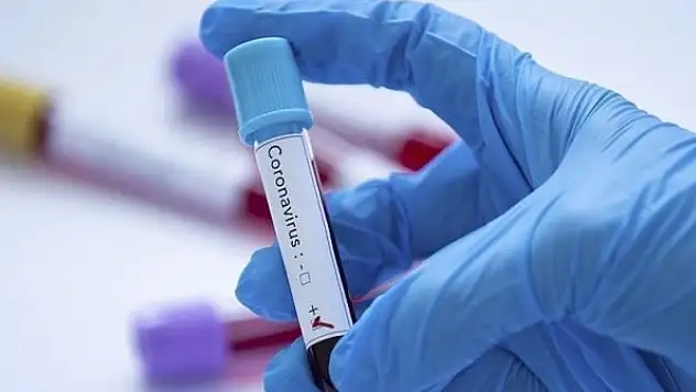 Eğitimli köpekler ter kokusundan Kovid-19'u tespit etti