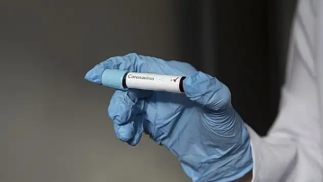 Kovid-19'da verilen ilaçları kullanmamak hastalığın seyrini olumsuz etkiliyor