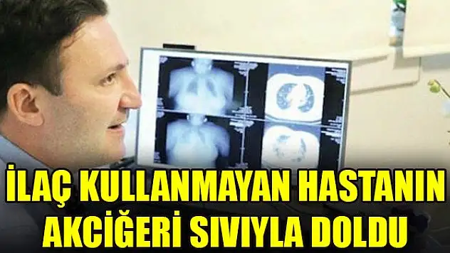 İlaç kullanmayan hastanın akciğeri sıvıyla doldu