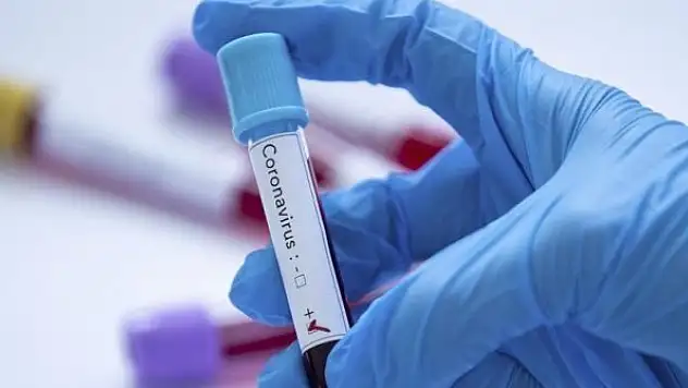 Türk bilim insanları koronavirüs teşhisini 10 saniyeye düşüren tanı sistemi geliştirdi