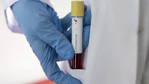 Malezya'da bir bakan daha COVID-19'a yakalandı