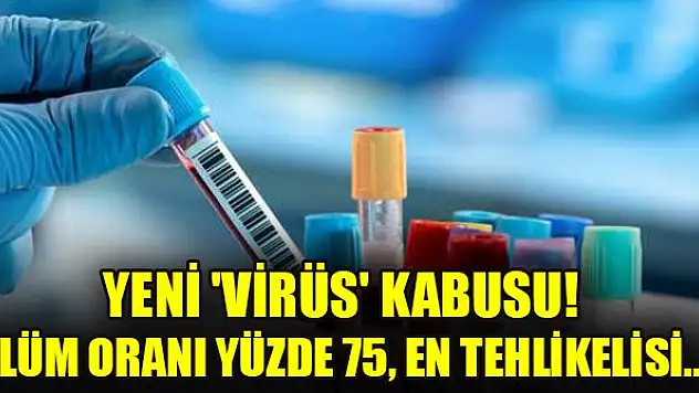 Yeni 'virüs' kabusu! Ölüm oranı yüzde 75, en tehlikelisi...