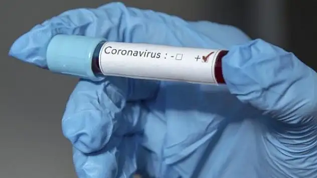 'Kutsal iksir' içen o ülkenin  Sağlık Bakanı virüse yakalandı