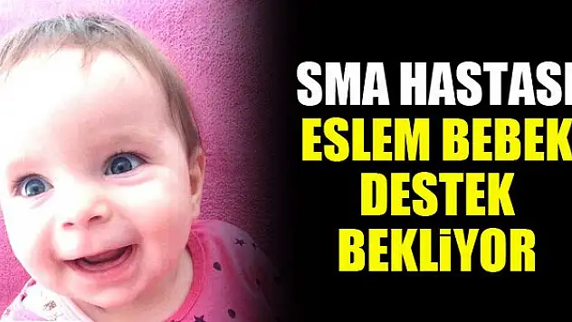 SMA hastası Eslem bebek destek bekliyor