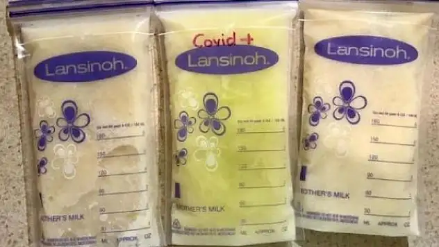 COVID-19 olan annenin sütü açık yeşil oldu