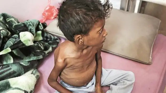 Yüz binlerce çocuk ölebilir