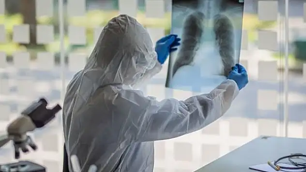 Covid-19 'antikor kokteyli' ilacının yüzde 81 koruyucu olduğu bildirildi