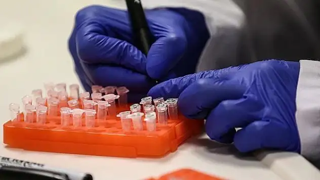 Türkiye'de 12 'Kovid-19 aşı' çalışması yürütülüyor