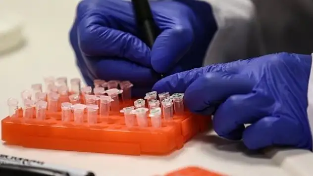 Toplu taşıtlarda daha önce keşfedilmemiş binlerce virüs ve bakteri var