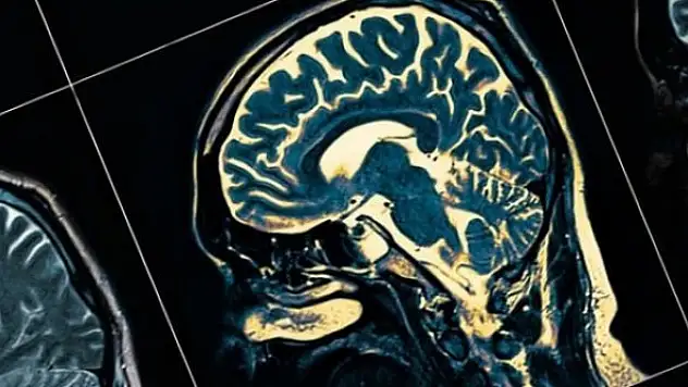 ABD'den 18 yıl sonra bir Alzheimer ilacına onay