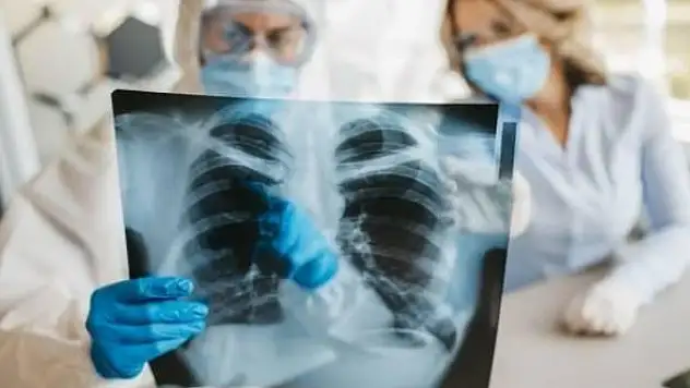 Oxford Üniversitesi'nin araştırması koronavirüs gerçeğini ortaya çıkardı