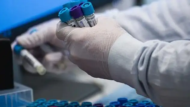 İsveç'te sahte PCR testi skandalına inceleme