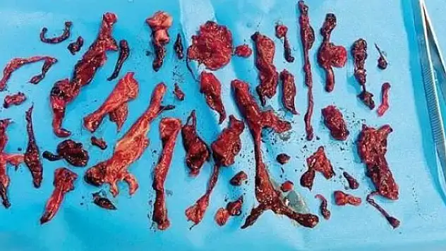 Covid-19 tehdidini ortaya koyan fotoğraf!