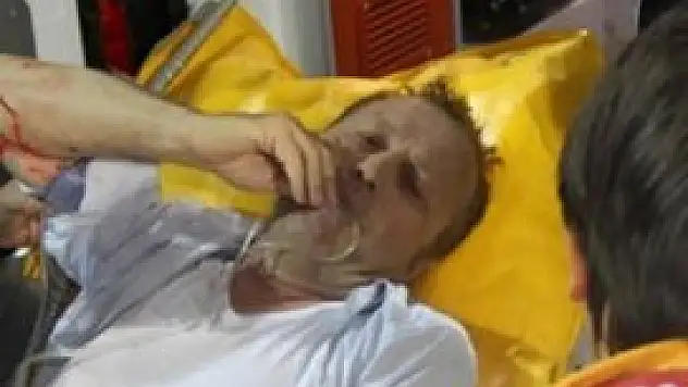 İbrahim Yazıcı yoğun bakımda