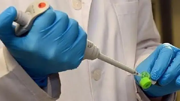 ABD'de Monkeypox virüsü alarmı: 200'den fazla temaslı izleniyor