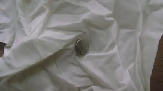 Çocuğun kulağına saat pili kaçtı