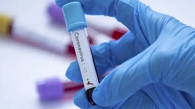 Paralimpik Oyunları'nda vaka sayısı 230'a çıktı