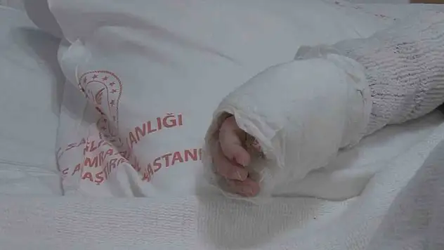 Minik bebek, kaynar suyla yandı