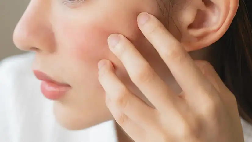 Cilt kuruluğunun gizli sebebi