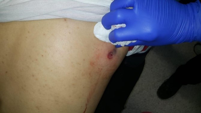 Yunan güvenlik güçleri mültecilere ateş açtı: 1 ölü, 5 yaralı