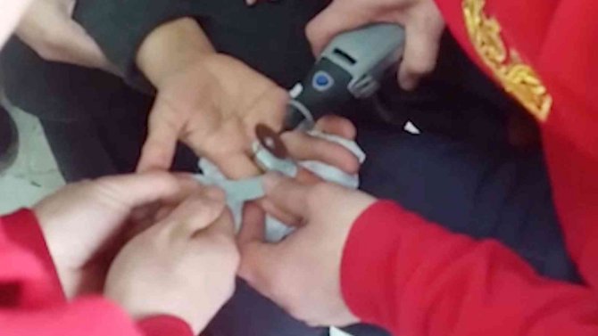 Parmağına sıkışan yüzüğü itfaiye çıkardı