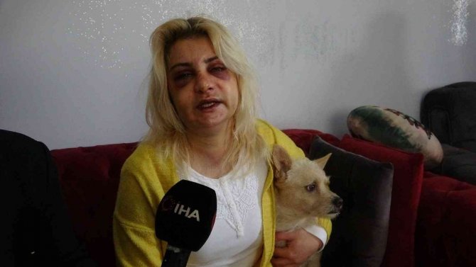 Hatay’da yalnız yaşayan kadın evinde darp edildi