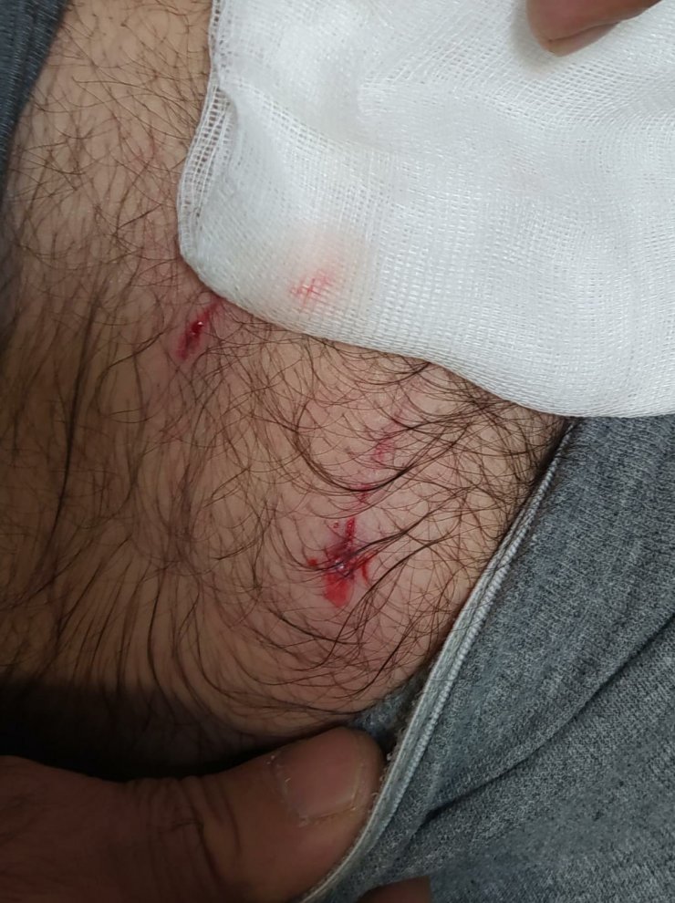 Köpeklerin saldırısına uğrayan baba- oğul yaralandı