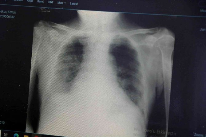 Uzmanlar, Kovid-19’un birkaç ay içerisinde biteceğini öngörüyor