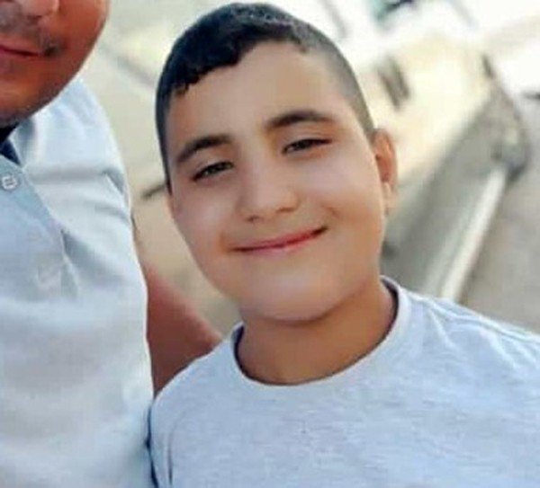 Ekmek almak için evden çıktı komalık oldu