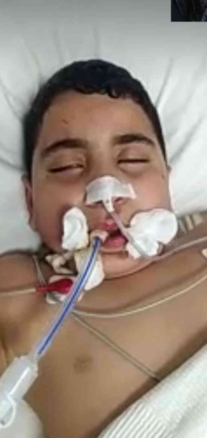 Ekmek almak için evden çıktı komalık oldu