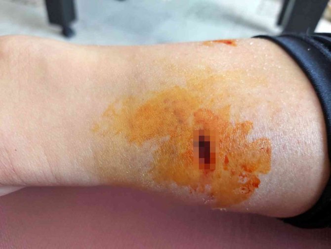 Antalya’da yasaklı cins sokak köpeği dehşeti yaşattı