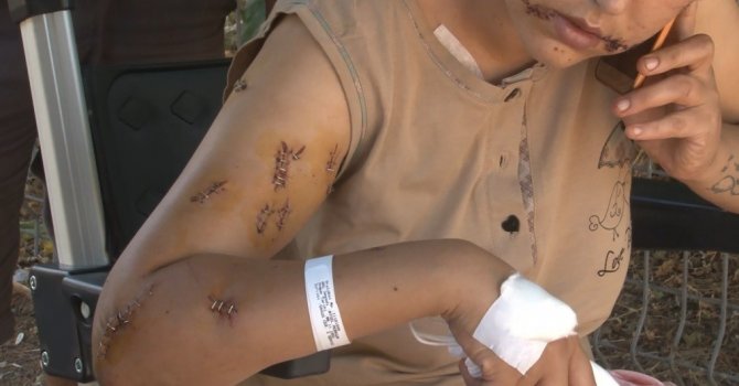 Genç kadının darp davasında 9 yaşındaki çocuk uzman eşliğinde dinlendi