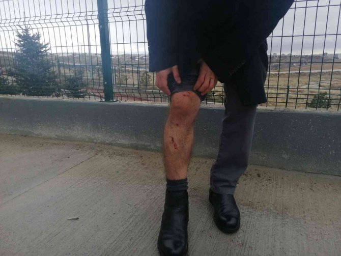 Köpek sürüsünün saldırısına uğramıştı, korku dolu o anları anlattı