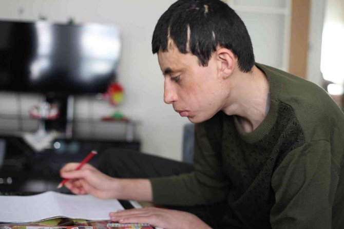 Kezzap atılan engelli çocuk ile ailesinin yaşam mücadelesi