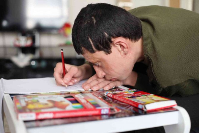 Kezzap atılan engelli çocuk ile ailesinin yaşam mücadelesi