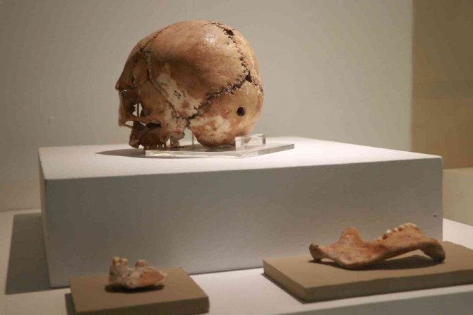 Dünyanın ilk beyin ameliyatı binlerce yıl önce Aksaray’da yapıldı