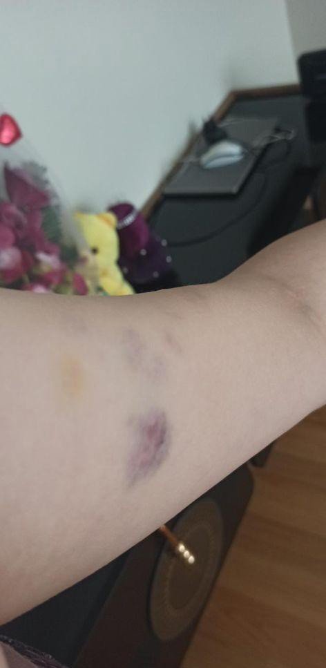 Boşanma aşamasındaki kocasının adliye koridorunda darp ettiği kadın: "Ölmek istemiyorum”