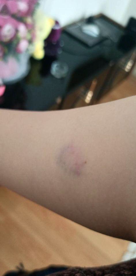 Boşanma aşamasındaki kocasının adliye koridorunda darp ettiği kadın: "Ölmek istemiyorum”