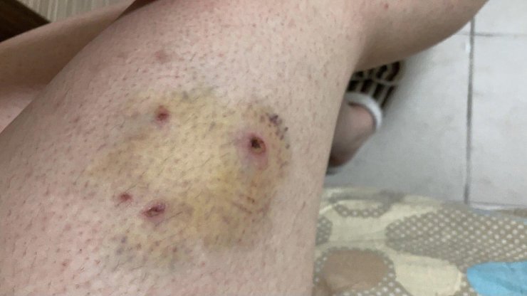 Kampüste köpek saldırısına uğradı  