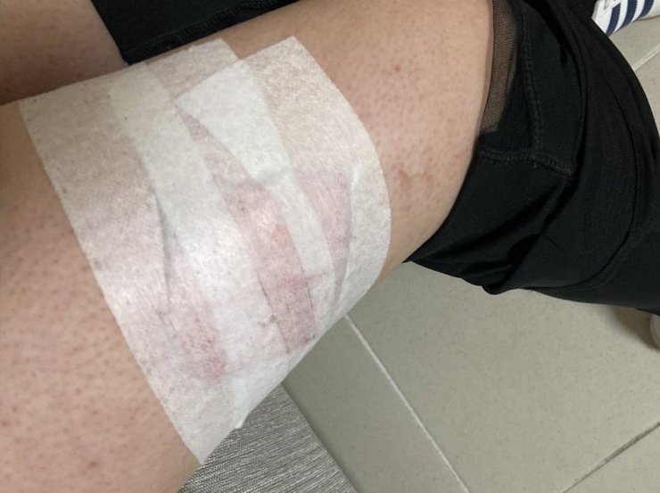 Kampüste köpek saldırısına uğradı  