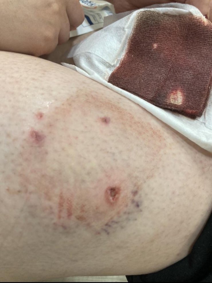 Kampüste köpek saldırısına uğradı  